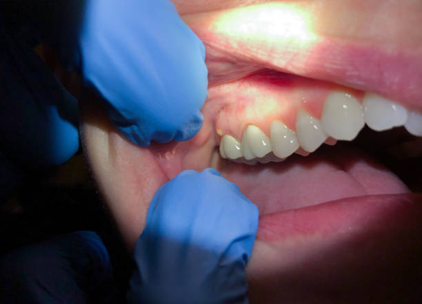 Best Pediatric Emergency Dentist in Apison, TN